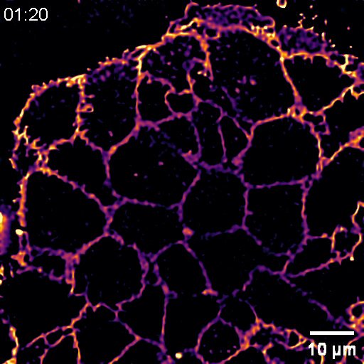 Our fourteen-year-old work is out in Nature Metabolism! Using zinc dye to image hundreds of insulin secretions within the intact islet, we reveal only a portion of islet b-cells exocytosis upon glucose stimulation (readily releasable b-cells).