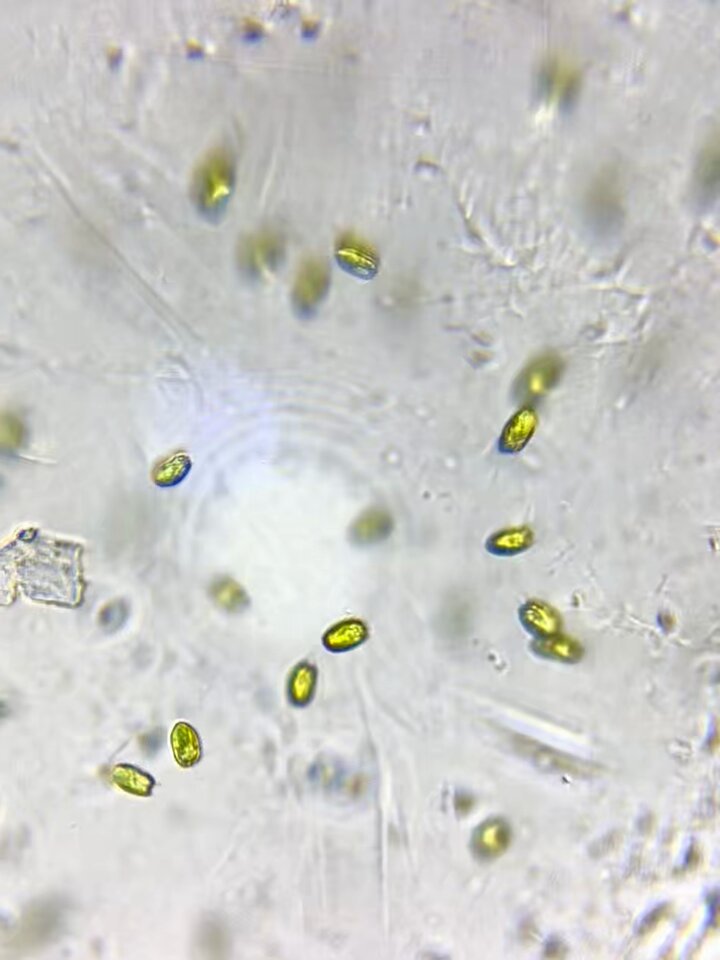TENGAのスマホカメラで精子観察するレンズ、あたりまえだけど他の微生物もいい感じに撮影できて笑ってる