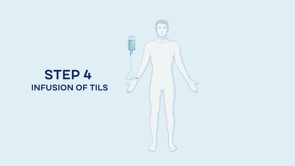 Join Moffitt's President and CEO, Dr. Patrick Hwu, as he shares insights on the recent U.S. FDA approval of a groundbreaking treatment for advanced melanoma. Discover how TIL therapy is revolutionizing cancer treatment. #CancerResearch