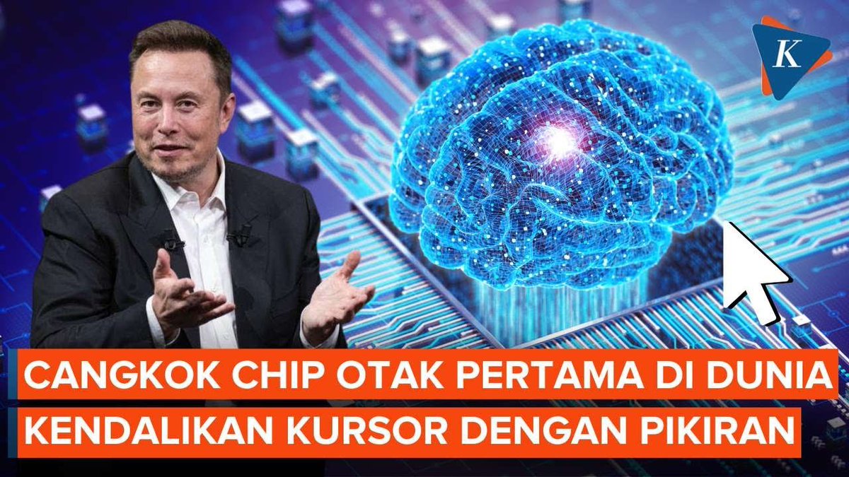 Manusia Cangkok Chip di Otak Pertama di Dunia, Bisa Gerakkan Mouse dengan Pikiran ~N #Chip #CangkokChip