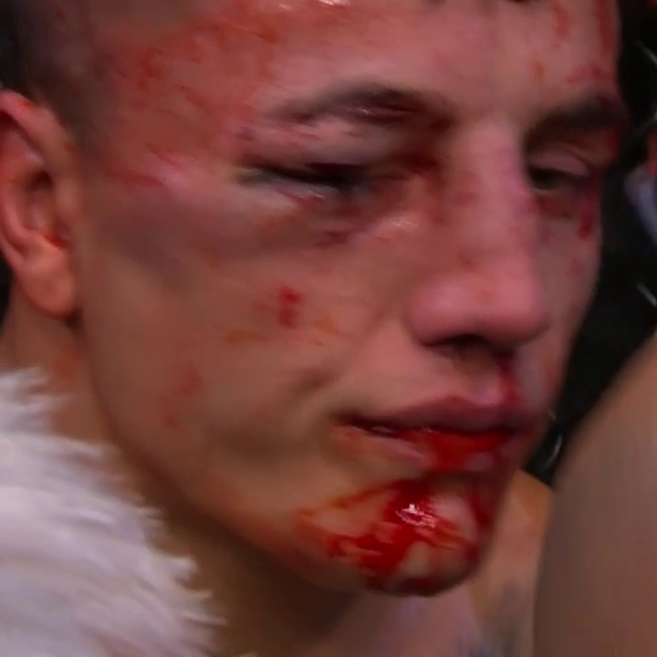 El castigo en el rostro de Francisco Prado. 😨 #UFCMexico
