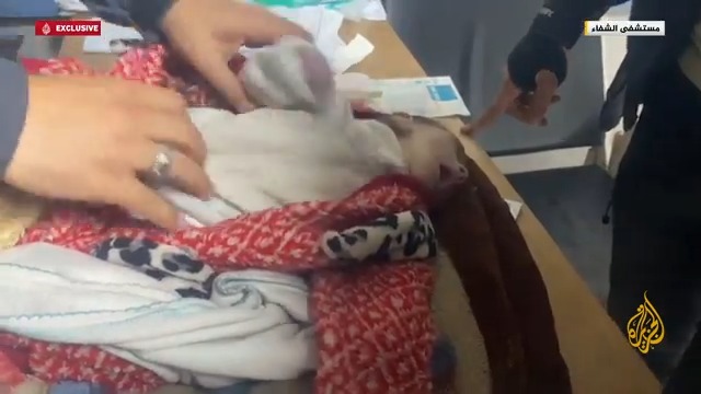 وفاة الرضيع محمد فتوح (45 يوما) نتيجة الجفاف ونقص حاد في التغذية حيث لم يشرب الحليب لعدة أيام بسبب المجاعة وقلة الطعام في شمال غزة