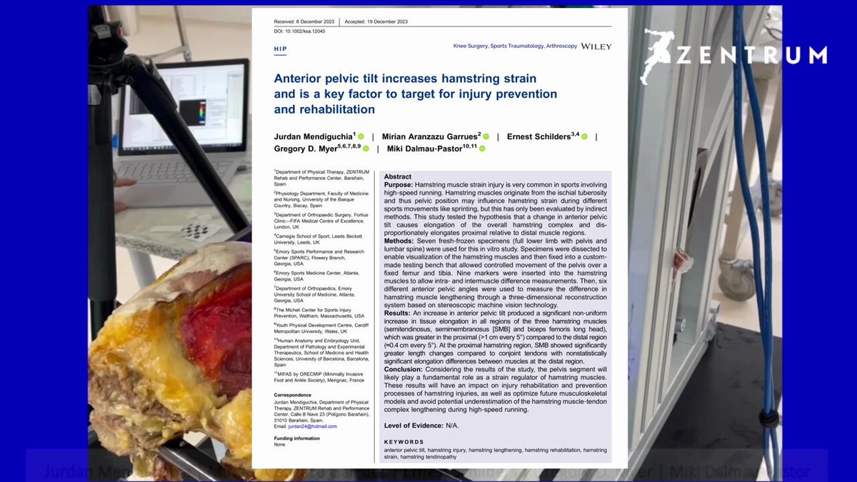 🚨🚨 New article videoabstract🚨🚨 Key points🔑 ⬆️APT ➡️⬆️STRAIN in all three hams muscles (SMB, ST,BF) Proximal strain (like sprinting)>distal Pelvis>femur>tibia Pract appl: hams strain rehab &amp; prevention, hams prox tendinopathy, hams avulsion post - surgery rehab