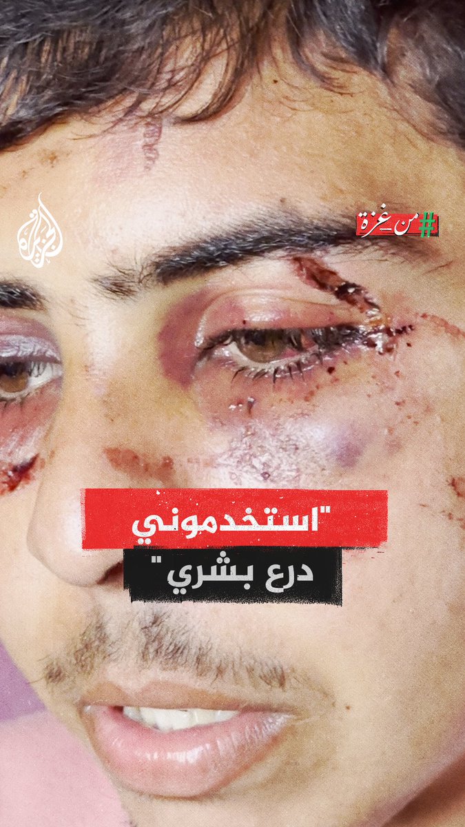 "التعذيب أصعب شيء".. رمضان شملخ شاب من قطاع #غزة، اقتحم جيش الاحتلال منزل عائلته وعذبه واستخدمه "كدرع بشري" ثم أجبره للذهاب إلى الجنوب #من_غزة