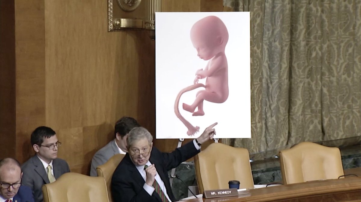 Democrats held a hearing on abortion. When I walked them through the violent steps doctors take to kill a baby at 21 weeks, a Democrat cut me off. If abortion is too horrific for liberals to even hear about, shouldn’t they agree it’s too horrific to support? #ProLife