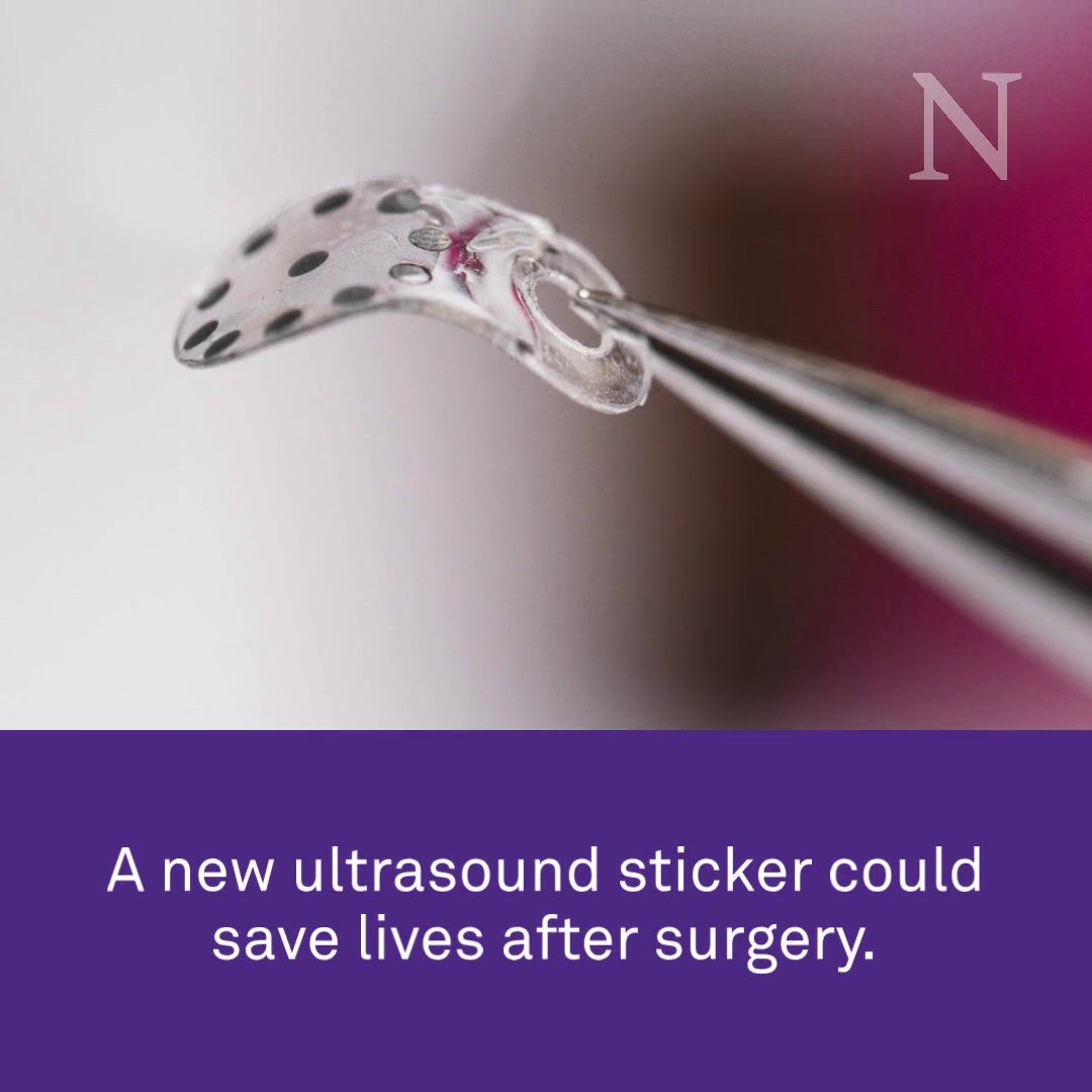 Researchers have developed a first-of-its-kind sticker that can detect post-surgical complications with a standard ultrasound: Querrey Simpson Institute for Bioelectronics | Northwestern Engineering | Northwestern Feinberg School of Medicine