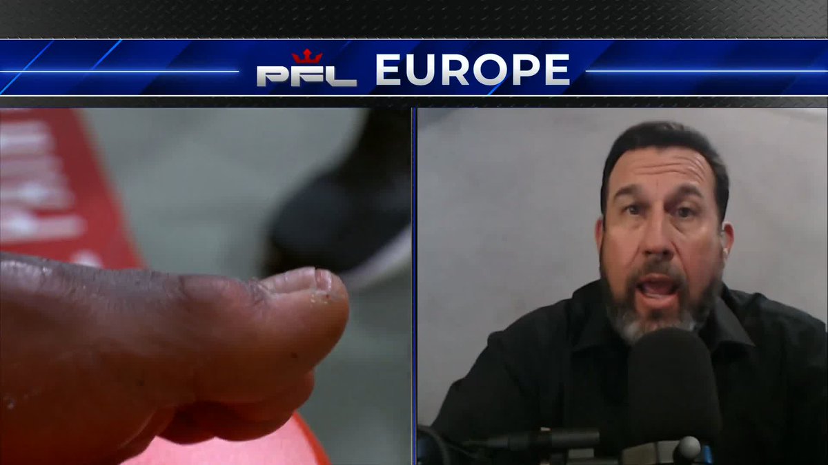 🥊🇫🇷 À cause d’une écharde plantée dans le pied, Cédric Doumbé a dû interrompre son combat face à Baki, qui l’a remporté par forfait.