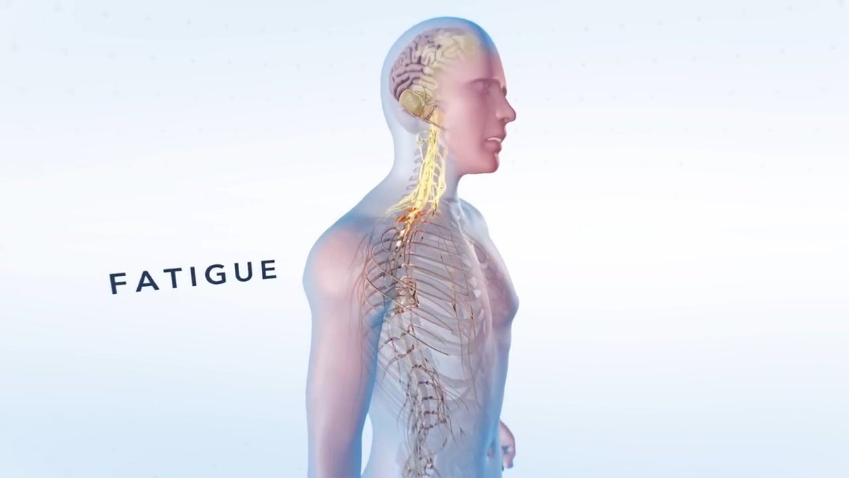 What is MS? Multiple sclerosis is a disease that impacts the brain, spinal cord and optic nerves, which make up the central nervous system and controls everything we do. Watch this video to learn more.