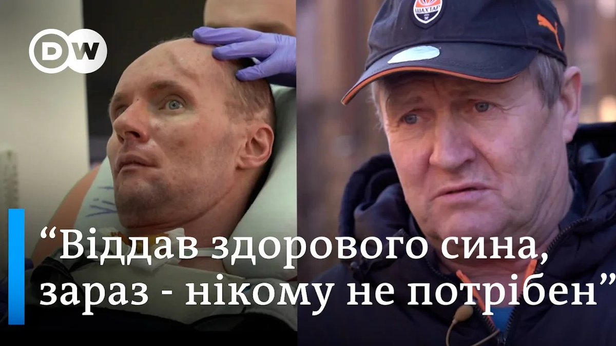 Військовий ЗСУ Віталій Шумей отримав важке поранення на фронті. Вже півтора року за ним доглядає батько і намагається добитися виплат для сина. Наскільки системна ця проблема і як вирішити проблеми з виплатами?
