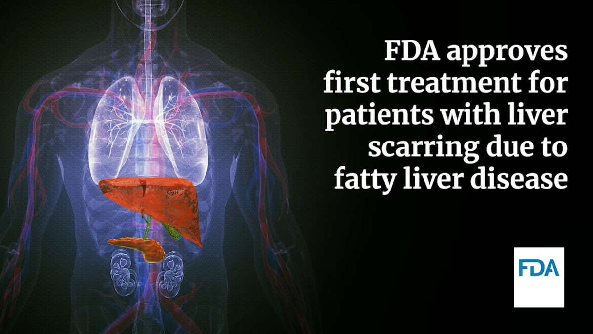 Today, FDA approved a medication for the treatment of adults with noncirrhotic non-alcoholic steatohepatitis (NASH) with moderate to advanced liver scarring (fibrosis), to be used along with diet and exercise.