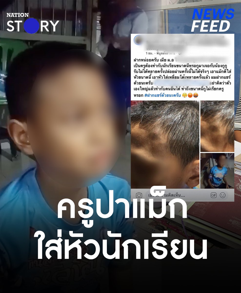 โซเชียลเดือด!! หลังมีคลิปเด็กชาย 9 ขวบ เล่าทั้งน้ำตา ถูกครูปาแม็กใส่หัวจนบวมปูด เหตุยืนดูทีวีหน้าห้อง แม่สุดทน!! เข้าแจ้งความ เผยลูกชายสมาธิสั้น จึงไม่ได้ยินครูพูด ด้านครูแจ้งความกลับ เหตุทำให้เสียชื่อเสียง #คุณครู #ครู #นักเรียน #NationSTORY
