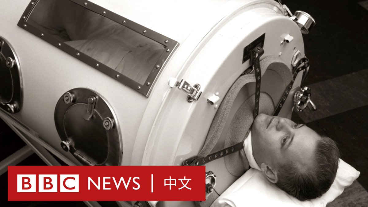 被称为“铁肺男”的小儿麻痹症患者最近去世，享年78岁。来自美国得克萨斯州的保罗·亚历山大（Paul Alexander）六岁时患上小儿麻痹症，之后的七十年里，他一直生活在被称为“铁肺”的仪器中。在疫苗变得普遍，这台机器拯救了成千上万像他一样的人。让我们看看“铁肺”是如何运作的。