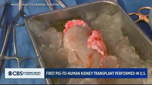 For the first time ever, doctors at Massachusetts General Hospital successfully transplanted a kidney from a genetically modified pig into a 62-year-old man, who is now recuperating following the groundbreaking procedure.