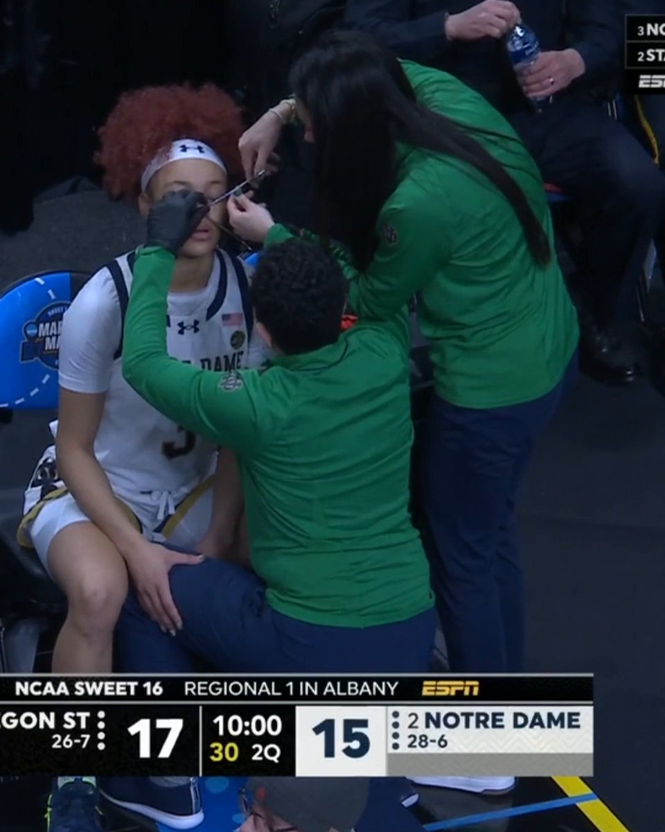 Hannah Hidalgo missed some time in Notre Dame's Sweet 16 matchup with Oregon State to have her nose ring removed.