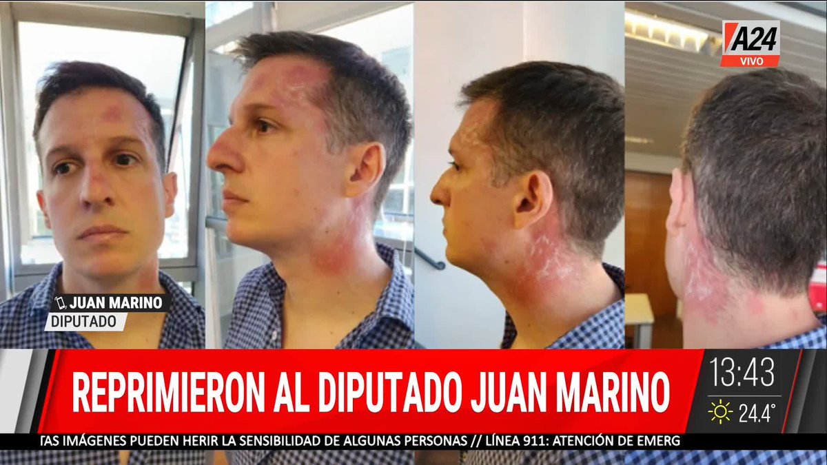 No hubo reprensión, se aplicó la ley como corresponde. Se acabo el cortar la calle e interrumpir el normal funcionamiento de la Ciudad. No puede haber progreso, si no hay orden.