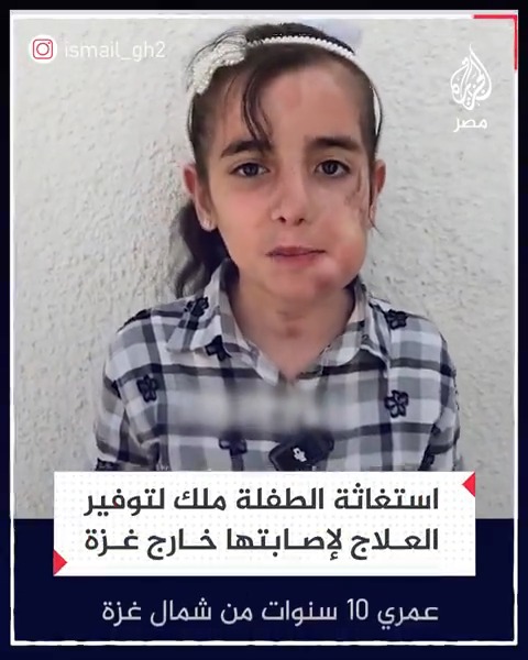 بعد إصابة بوجهها.. طفلة فلسطينية تستغيث من أجل توفير علاج لها خارج غزة