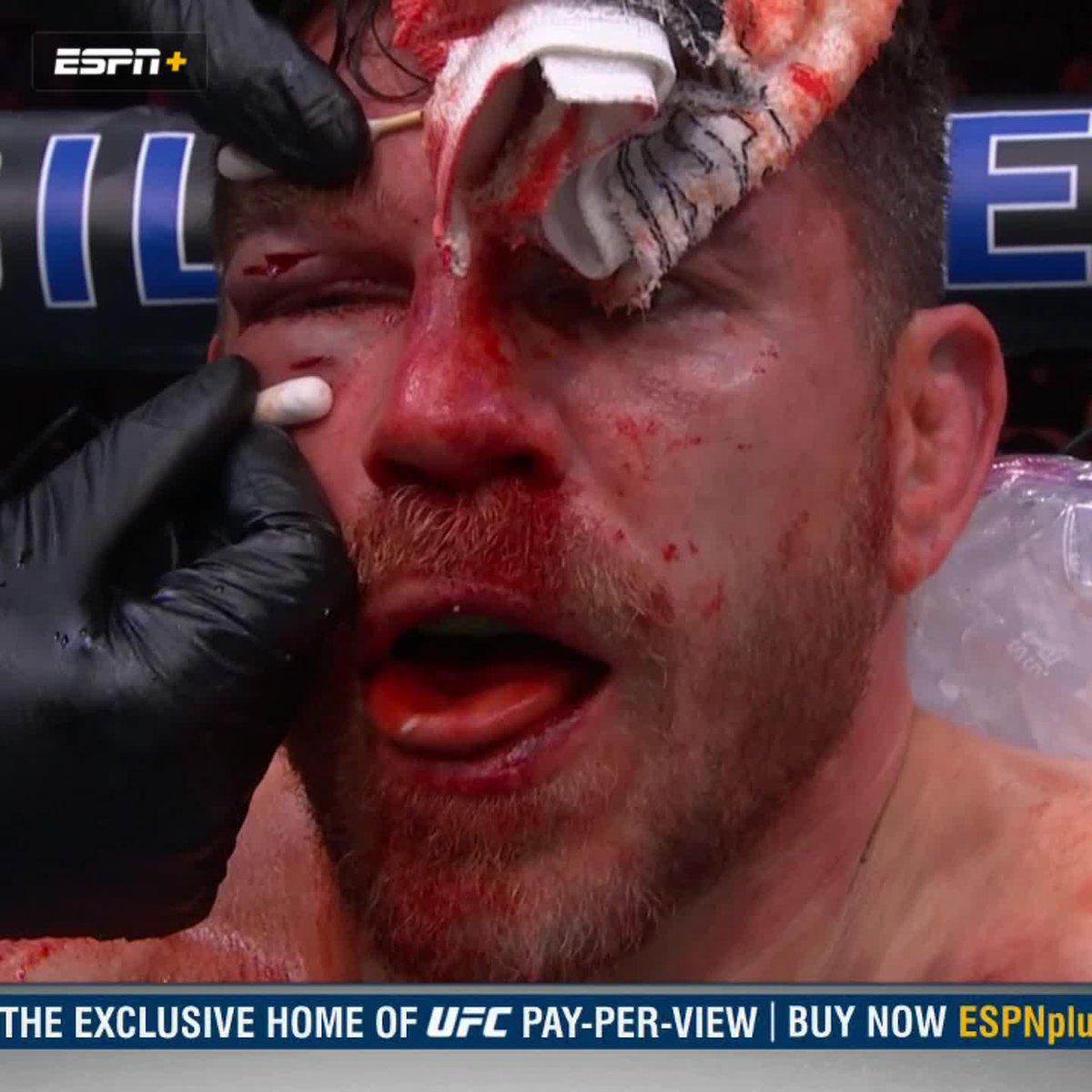 THE CUT ON JIM MILLER'S FACE 😳 #UFC300