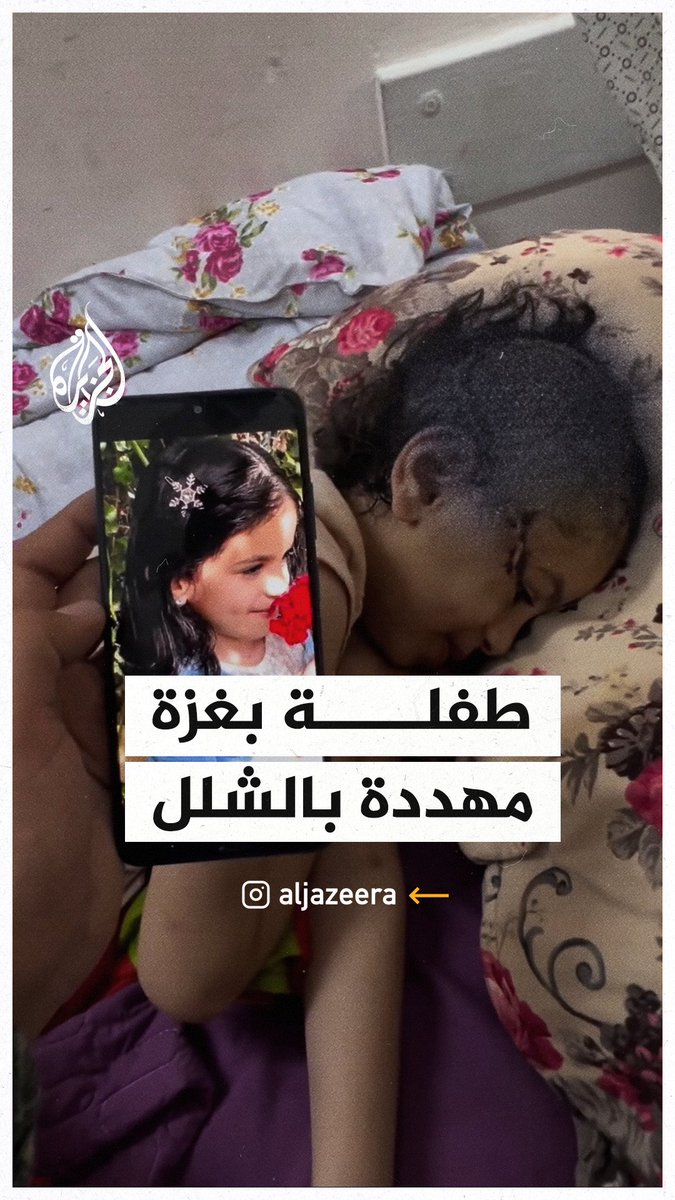 "نفسي أركض وألعب".. استغاثة لعلاج طفلة مُهددة بالشلل لإصابتها بشظية برأسها #حرب_غزة