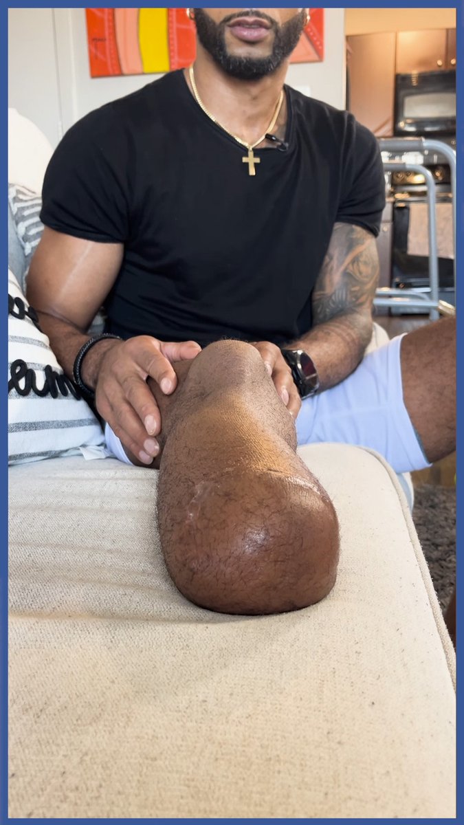 "It's not about how we fall; it's about how we get back up." Nelson Thomas, known for his appearances on "The Challenge," discusses his amputation, recovery process, and his desire to motivate others with Walt Maciborski. More Nelson Thomas⬇️