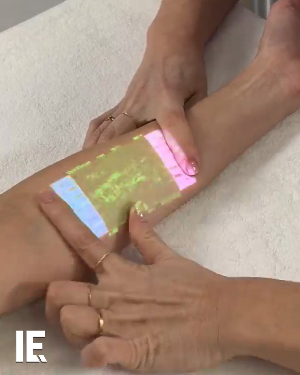 Vein scanning technology is a relatively new innovation in medicine. It non-invasively shows a patient's veins and bloodflow. That allows doctors to spot any problems in advance, and speed up treatment.