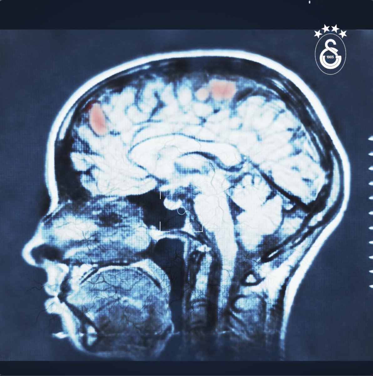Ne yaparsanız yapın hafızalarınızdan silemeyeceksiniz… 🧠