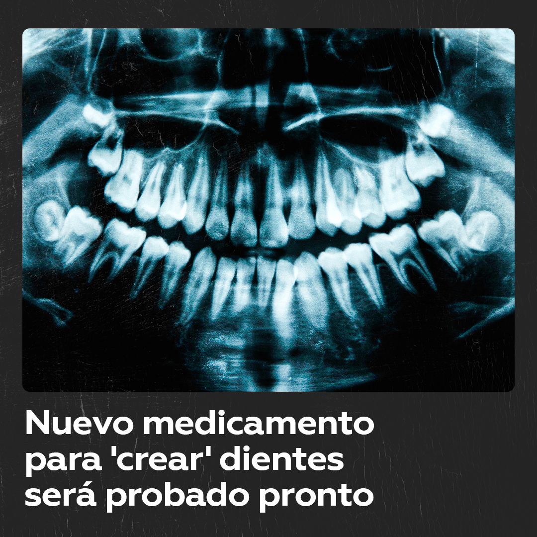 🦷 En septiembre próximo, la Universidad de Kioto (Japón) iniciará pruebas en humanos del primer medicamento para hacer crecer dientes.