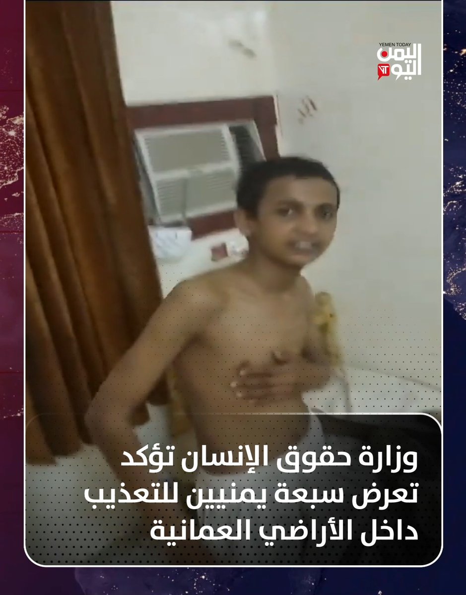 وزارة #حقوق_الإنسان تؤكد تعرض سبعة يمنيين للتعذيب داخل الأراضي #العمانية