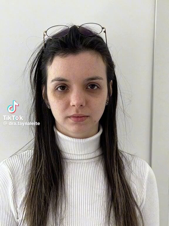 Tem muito médico e dentista por aí fazendo harmonização ruim mas não tem como não admitir que alguns são verdadeiras fadas da beleza