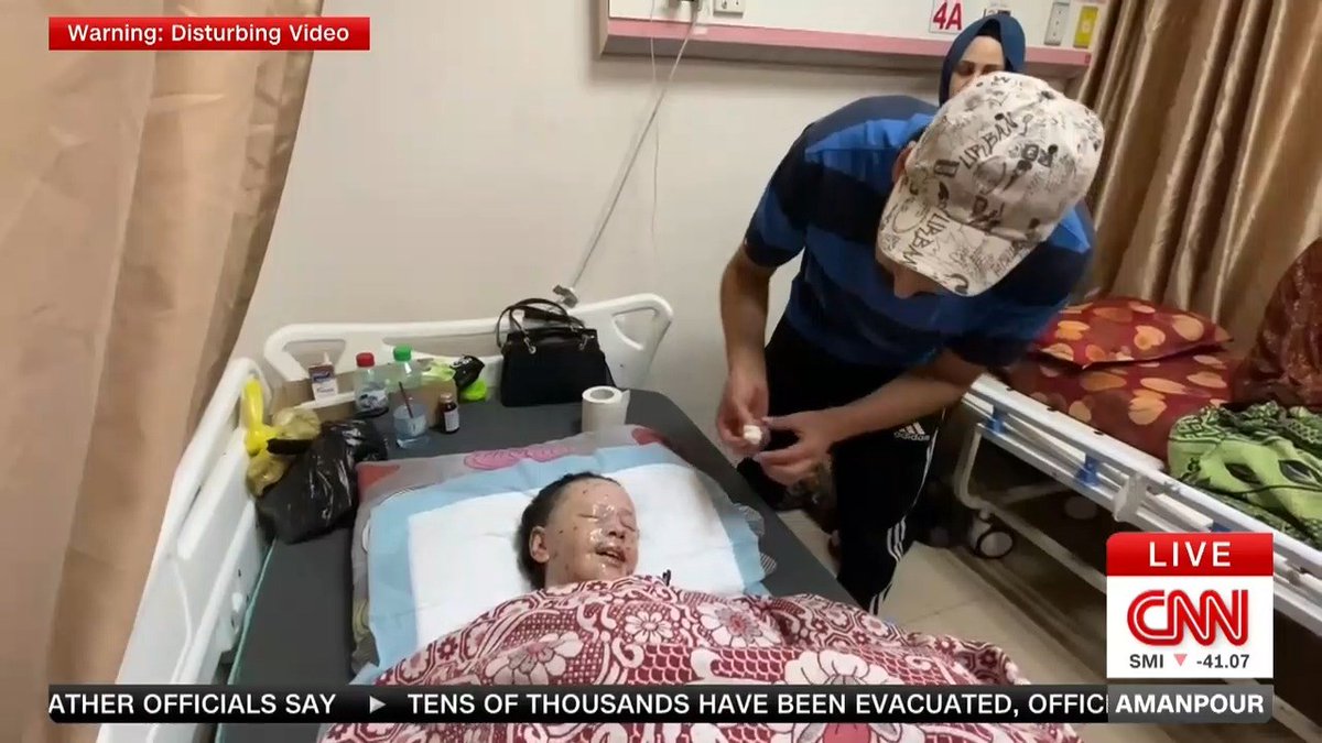 “I miss seeing mama.” Since the strike, nine-year-old Hanan has been unable to open her eyes -- one of thousands trapped in Gaza, without hope for treatment they need. Paula Hancocks reports, with images difficult to watch – but Hanan’s parents want their daughter to be seen.