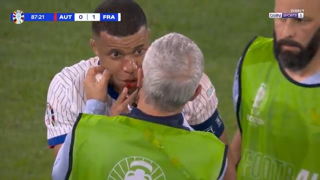 🚨😰 NEZ CASSÉ POUR KYLIAN MBAPPÉ ? 👃🩸 Après un gros choc, l'attaquant Français est contraint de quitter le terrain avec le nez en sang ! #AUTFRA #EURO2024