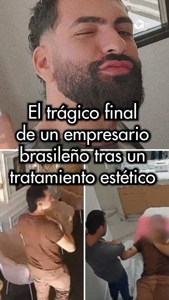 Esta influencer se las daba de experta en peeling y su negligencia terminó con la vida de un joven de 27 años.⚠️