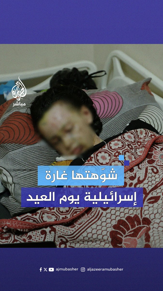 حنان عقل.. طفلة فلسطينية شوّهتها غارة للاحتلال يوم العيد تناشد للعلاج بالخارج #الجزيرة_مباشر #غزة