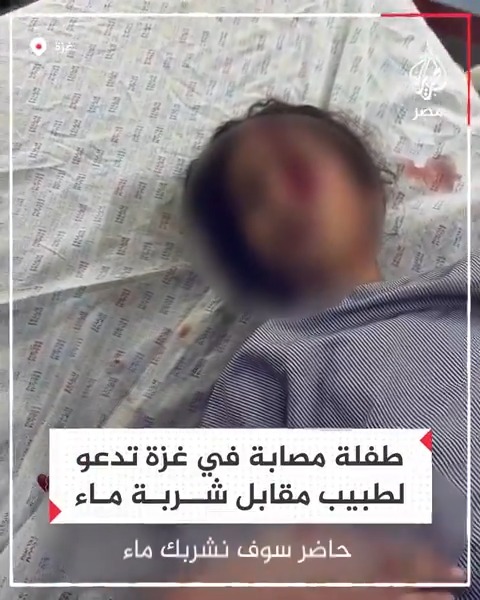 "الله يرزقك بكيس طحين".. دعوة طفلة مصابة في غزة لطبيب مقابل شربة ماء