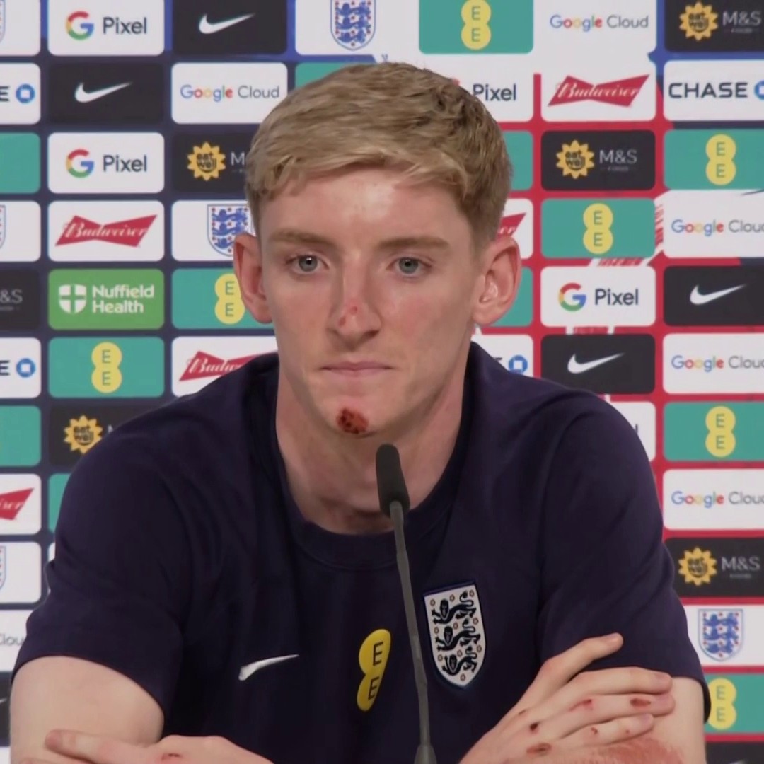 "If people are being negative it's only because they expect a lot from you" 💪 Anthony Gordon doesn't feel bothered by the online negativity about England's performances so far in Euro 2024 ⬇