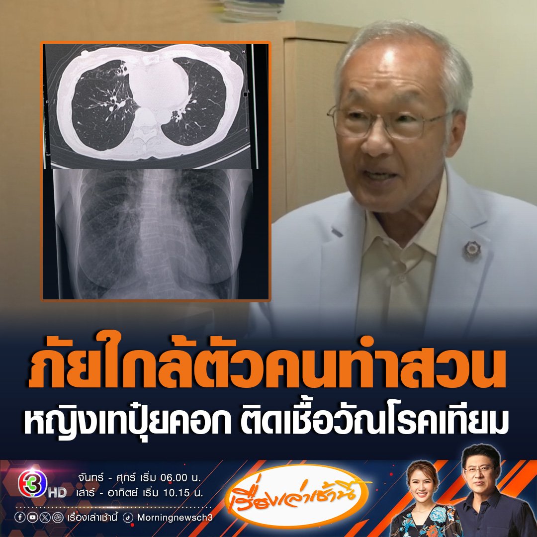 #เรื่องเล่าเช้านี้ หมอมนูญ เผยเคสคนไข้ หญิงวัย 64 ปี ร่างกายแข็งแรง แต่จู่ๆมีไข้ ไอ มีเสลด น้ำหนักลด ตรวจพบวัณโรคเทียม 3 ชนิด เกิดจากการทำสวน ปลูกต้นไม้ แล้วเทปุ๋ยคอกเป็นประจำ ทำให้หายใจรับเชื้อโรคที่ลอยขึ้นมาในอากาศ แนะควรสวมหน้ากาก N95 ป้องกัน #ข่าวช่อง3 #ข่าวสังคม #วัณโรคเทียม