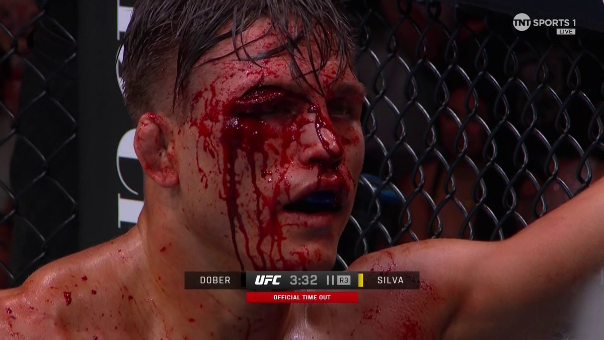 WHAT A CUT! 😬😬😬 Jean Silva gets the STOPPAGE against Drew Dober! #UFCDenver | LIVE on TNT Sports & discovery+