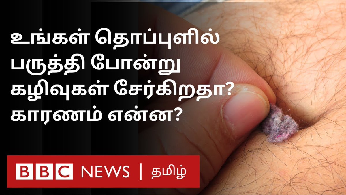 உங்கள் தொப்புளில் பஞ்சு போன்று கழிவுகள் சேர்கிறதா? காரணம் இதுதான்...