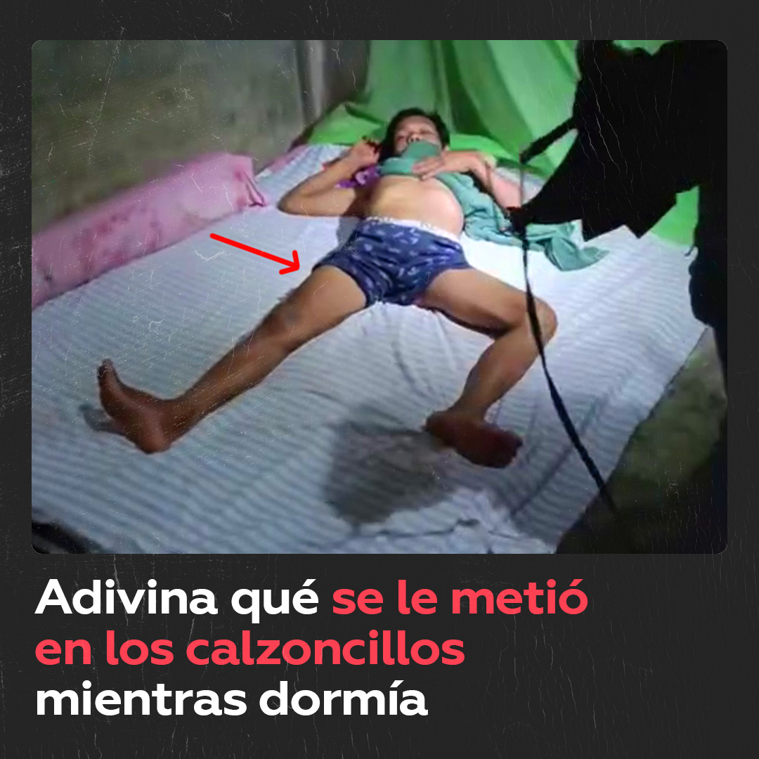 Despertarse nunca es agradable, pero pocos despertares se comparan con el que tuvo este hombre de Rayong, Tailandia. La situación lo obligó a quedarse inmóvil hasta que llegó ayuda especializada. 🎥 Más videos en Rumble 👉