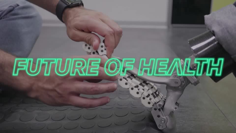 The SoftFoot Pro is a prototype prosthetic foot designed to simulate the anatomy of a real human foot. Unveiled by the Italian Institute of Technology in Genoa, Italy, researchers think it could be a game-changer
