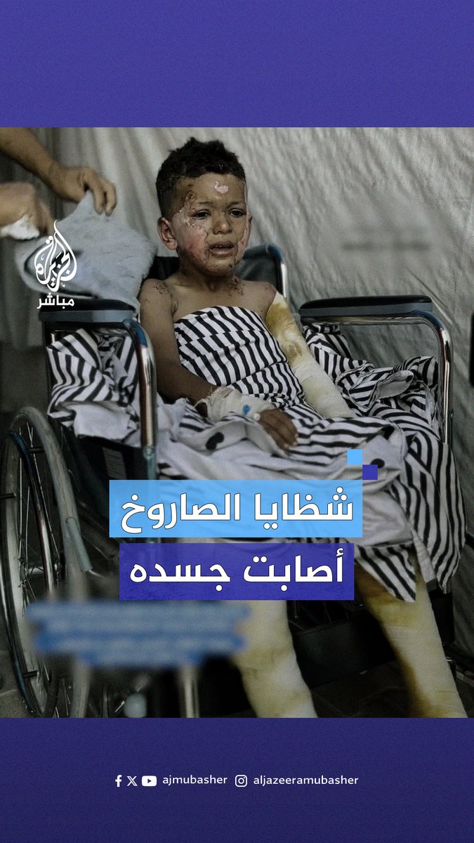 يبكي من الألم والصدمة.. حـ.ـروق بالغة في جسد طفل فلسطيني جراء إصابته بشظايا صاروخ في قصف إسرائيلي على قطاع غزة