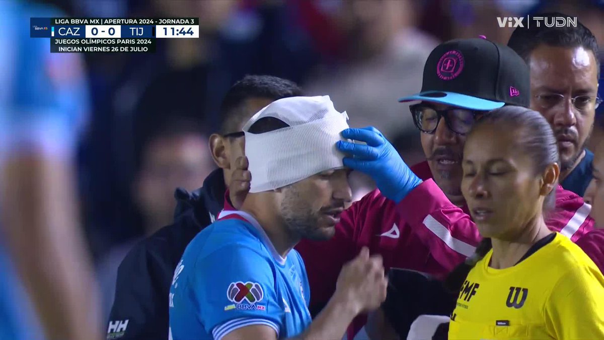 Le abren la cabeza a Nacho Rivero y no marcan penal 😱 🚂 0-0 🐶 🔴 EN VIVO 📺 VIX #LoNuestroEsElFutbol