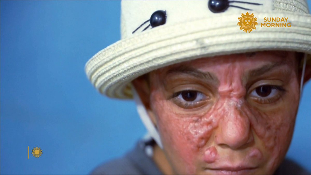 The Palestine Children's Relief Fund has rescued over 200 children from Gaza needing medical treatment. Tracy Smith discusses with doctors the dire conditions in Gaza and the impact on children following Israel's response to Hamas' attack last October.