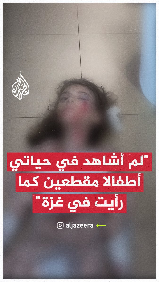 طبيب يهودي أمريكي عائد من غزة يقول إن الجيش الإسرائيلي قتل عمدًا أطفالًا بنيران قناصته في تصريحات لشبكة سي بي أس الأمريكية