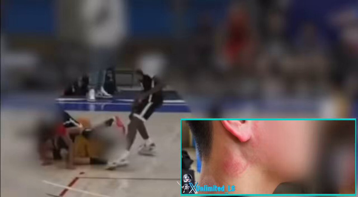 NEW: 13-year-old basketball player stomps on an opponent's head during a Bay Area game The game happened on Sunday at the College of Alameda against Payton's Place, another Bay Area team “He was down on the floor and this kid just came and just stomped on him and on his head” The injured player's family says that their son is now in concussion protocol and experiencing headaches “You could clearly see the size of his shoe on his face. My son suffered a concussion for the first time he played basketball” Police confirm that the investigation is ongoing and that the family has filed a report