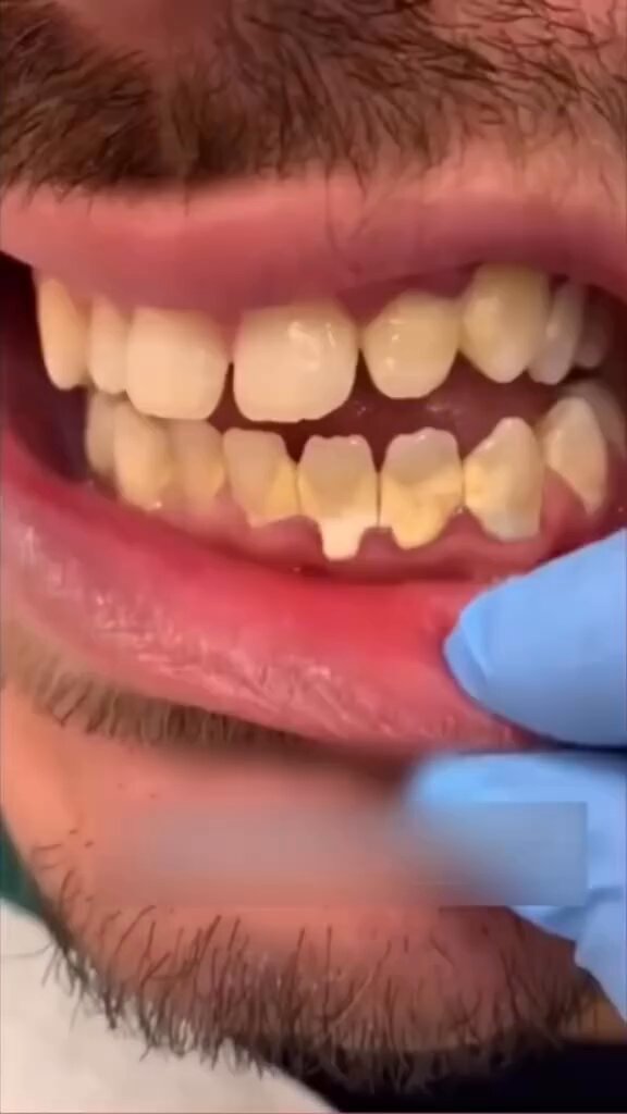 Here’s the natural way to whiten your teeth