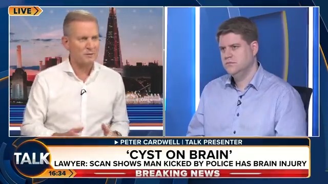 BREAKING: The man who was kicked and stamped in the head by a police officer at Manchester airport, has a cyst on his brain a lawyer for the family has said.