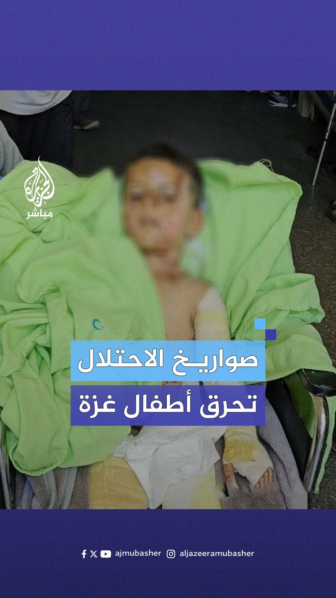 صراخ وبكاء.. أطفال من #غزة مصابون بحروق بليغة جراء الغارات الإسرائيلية المستمرة على القطاع #الجزيرة_مباشر