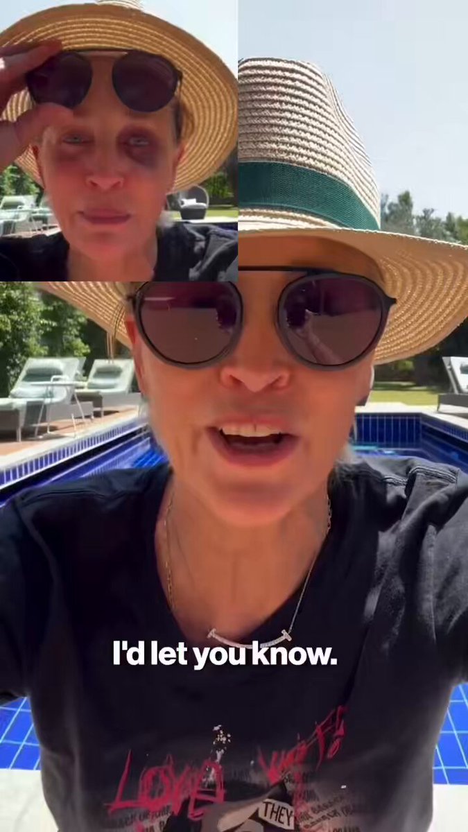 🔥🚨DEVELOPING: Hollywood Actress Sharon Stone randomly released a video explaining how she has got a black eye before the Golden Globe event for tomorrow. Sharon Stone: “I’ve been in so many hotels in so many countries that I got up in the middle of the night to be Didn't know where I was and smacked my face on the marble. No, nobody did anything to me And yes, I'm just fine and I'm having a great time and I'm being welcomed very beautifully on my trip everywhere that I've gone and I'm having just the greatest time and It's getting better, but it really is a good-looking shiner You should see what I did to that marble floor Thanks so much for caring about me. I care about you, too. Thank you.”