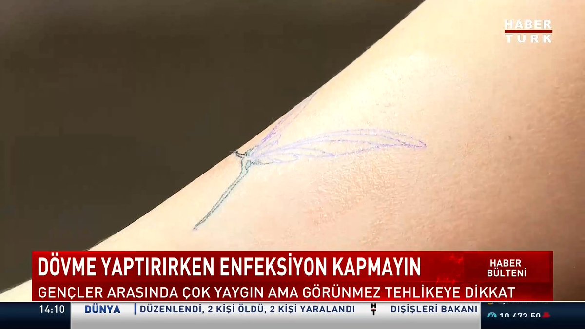 Dövme mürekkebinde enfeksiyon riski... Araştırmada mürekkeplerin üçte birinde bakteri bulundu. Dövme yaptırırken enfeksiyon kapmayın.