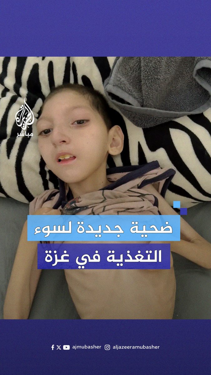 تحولت إلى هيكل عظمي.. سوء التغذية يهدد حياة الطفلة الفلسطينية رفيف الداية جراء حـرب التجويع الإسرائيلية على قطاع #غزة #الجزيرة_مباشر #غزة_لحظة_بلحظة